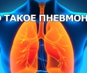 Vad är lunginflammation