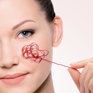 How to get rid of the capillaries on the face