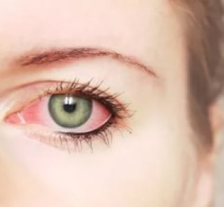 Bourse des yeux rouges, des causes et un traitement