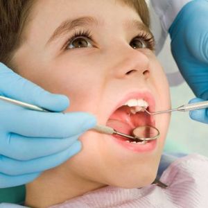 How to treat teeth to children