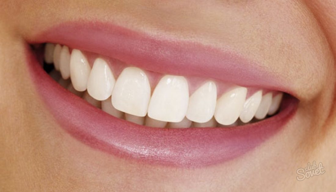 Cum de a elimina decalajul dintre dinții