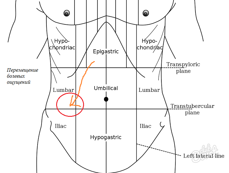 Аппендикс находится справа или слева. Правая подвздошная область аппендицит. Область живота аппендицит. Аппендицит локализация боли. Аппендицит расположение у женщин.