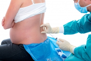 Epidurální anestezie při porodu