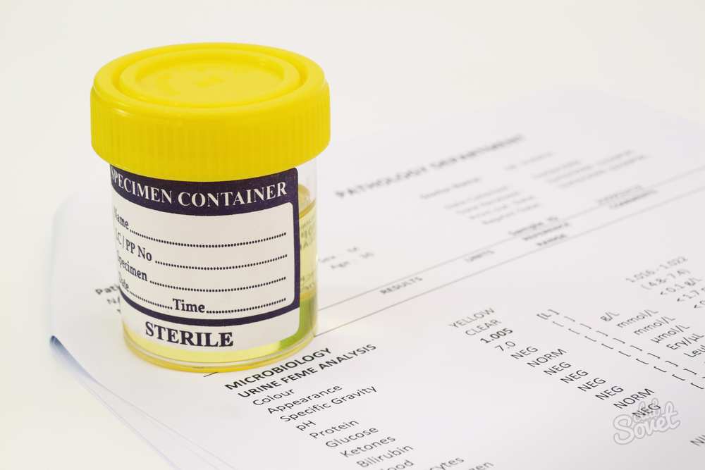 What shows the overall urine analysis