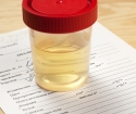 Kako donirati lonac sjetve urin