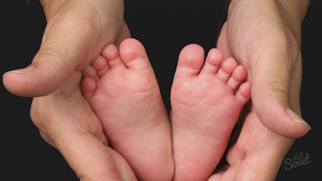 Deformazione del Valgus del piede nei bambini - Trattamento