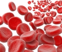 Hogyan lehet csökkenteni a hemoglobint