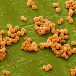 Staphylococcus nasıl tedavi edilir