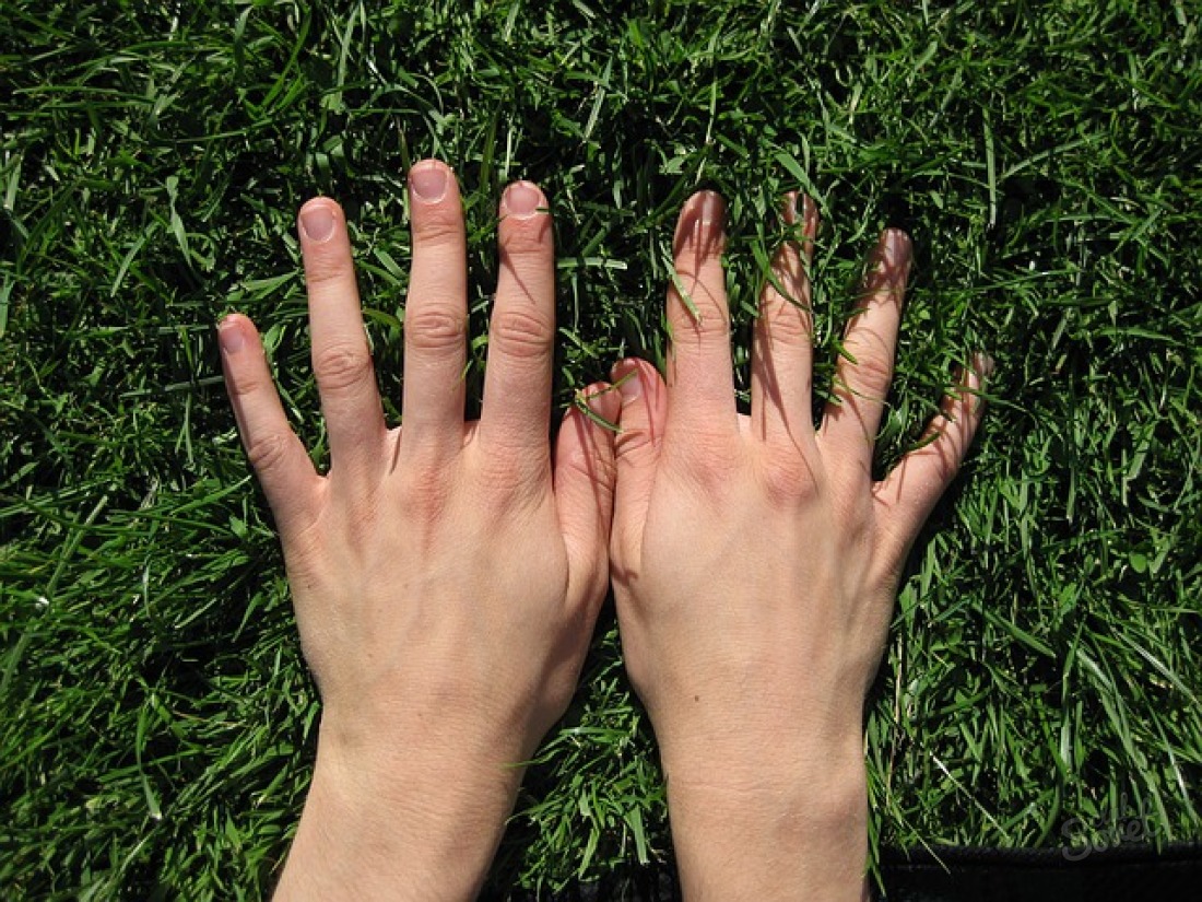 Beulen auf den Fingern der Hand - Hygroma