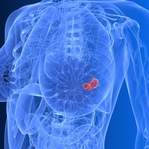 Foto Como determinar o câncer de mama