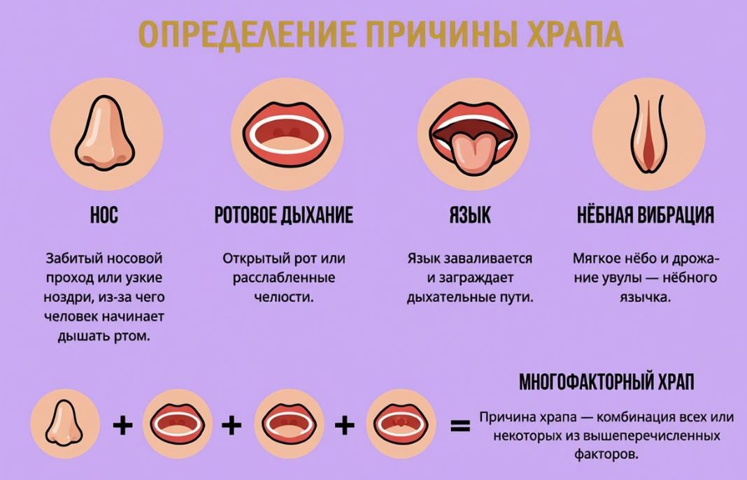 О каких заболеваниях и состояниях может свидетельствовать храп причины